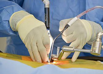 Minimally Invasive and Microscopic Surgery