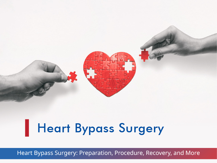 Heart Bypass Surgery: Preparation, Procedure, Recovery, and More