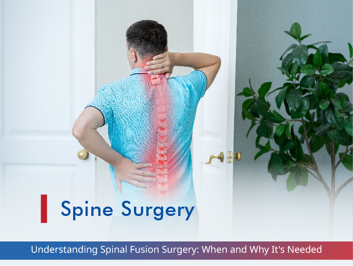 Understanding Spinal Fusion Surgery: When and Why It's Needed