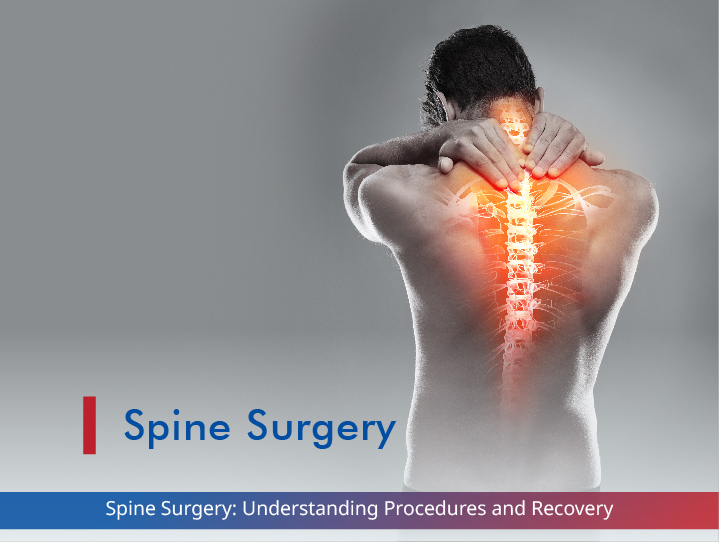 Spine Surgery: Understanding Procedures and Recovery