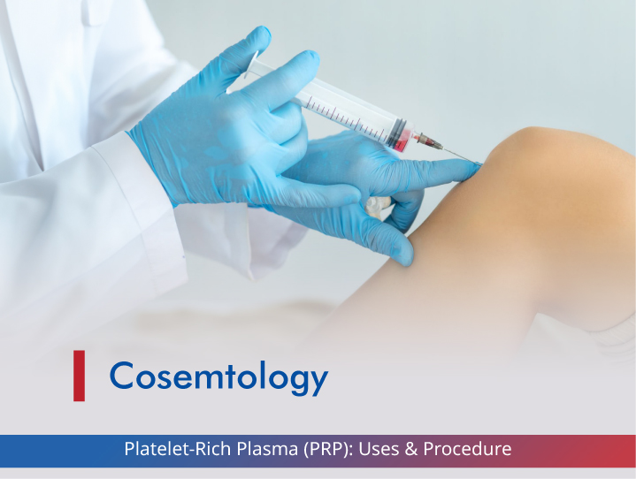 Platelet-Rich Plasma (PRP): Uses & Procedure