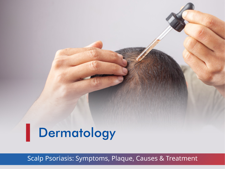 Scalp Psoriasis: Symptoms, Plaque, Causes & Treatment