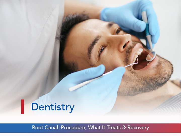 Root Canal: Procedure, What It Treats & Recovery