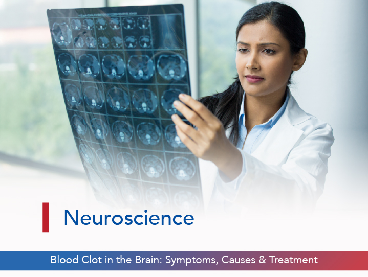 Blood Clot in the Brain: Symptoms, Causes & Treatment